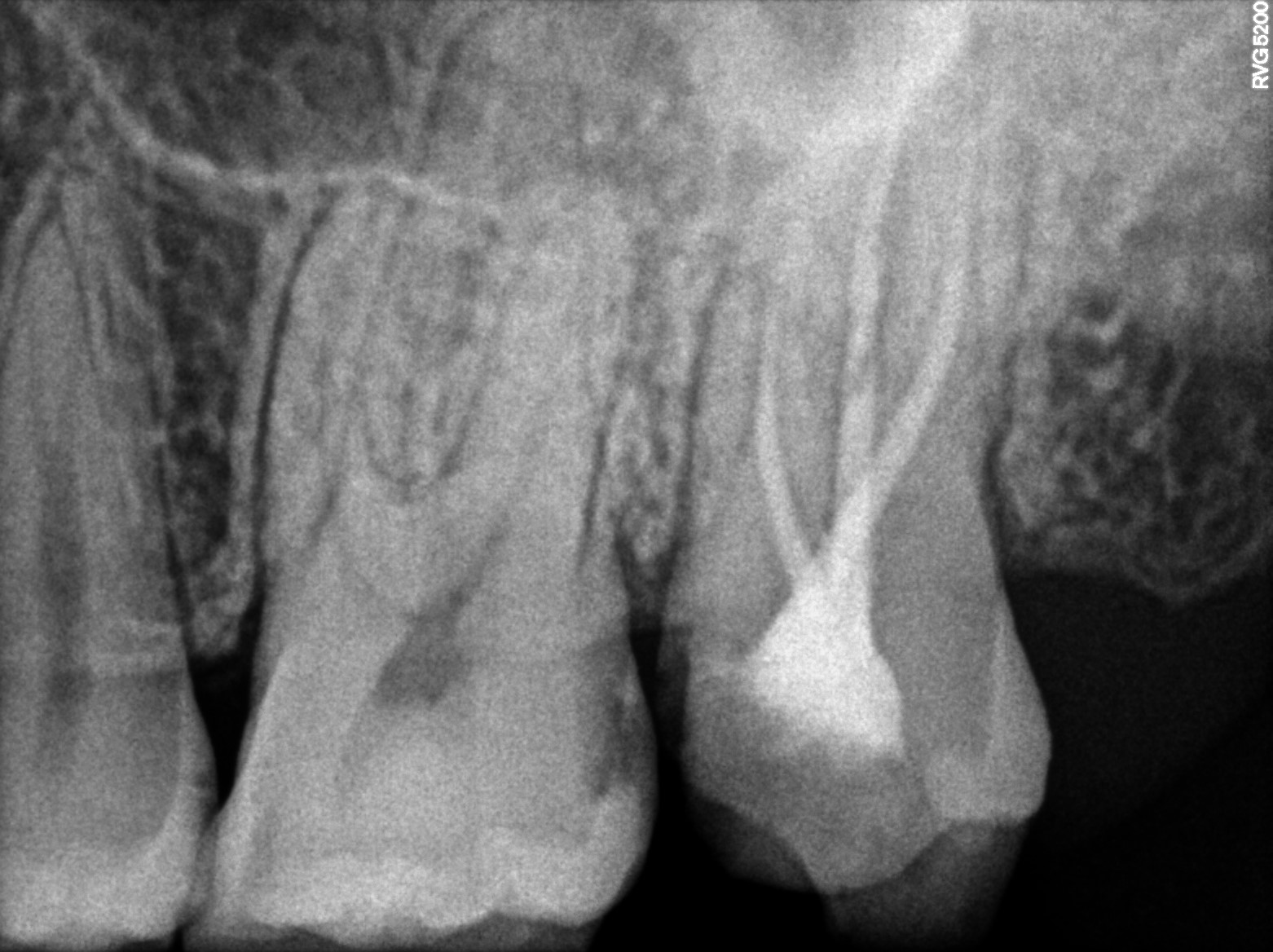 Dental X-ray